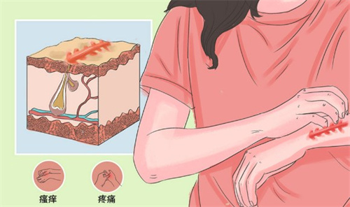 王连召治疗疤痕怎么样？王连召可信吗?王连召plasma去疤痕技术好很可信！