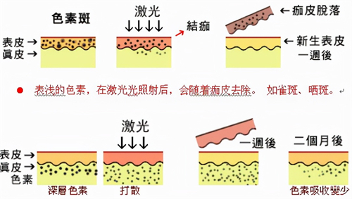 济南艺星整形医院祛斑怎么样?测评:设备_服务_报价_环境,得出结论点击看~
