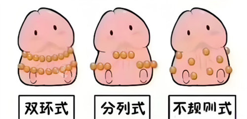 入珠手术动画3