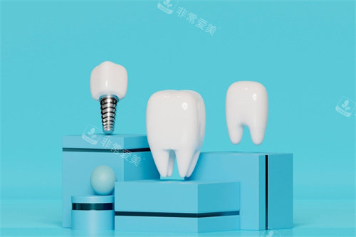 种植牙牙冠展示