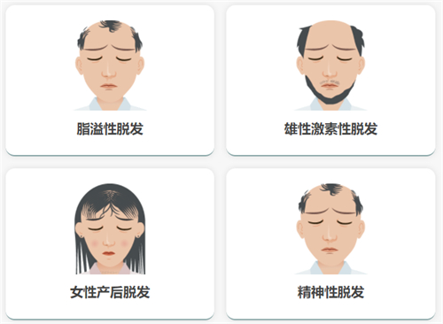 韩国布莱克植发医院怎么样?际线美学设计是强项！普通FUE 10元/单位+艺术种植18元/单位，附简介地址！