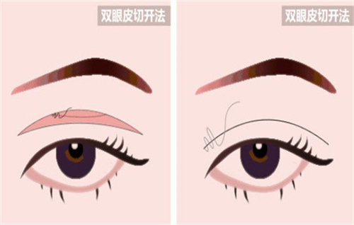 西安艺星医疗美容医院正规吗？资质扎实口碑赞，医美体验超靠谱