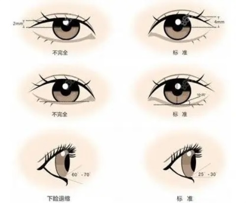 西安高一生美容医院正规吗？实力口碑看得见，合规医美让变漂亮更安心！