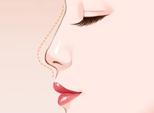  网络票选南宁整形美容医院排名前十位：华美脂雕/柏琳悦美修复/爱思特高难度手术，各有专长！