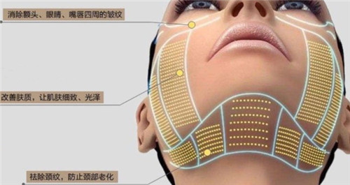 我在韩国做了Flx+ulthera热超联合治疗！250万韩币换紧致轮廓超值