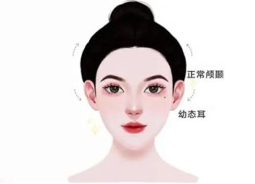 韩国全脸玻尿酸注射填充打造幼态脸并不馒化！建议姐妹还是要找做医美有经验的医院！