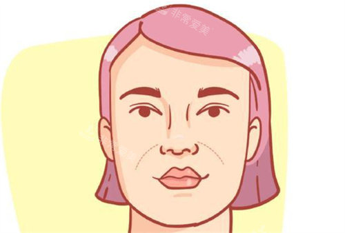 法令纹图片 法令纹图片