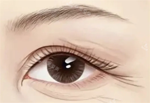 需要提眉切眉的情况