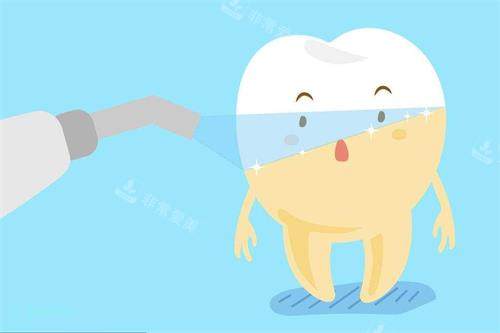 牙齿冷光美白示意图