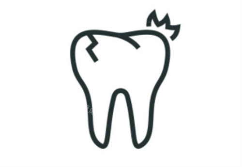 种植牙牙裂示意图