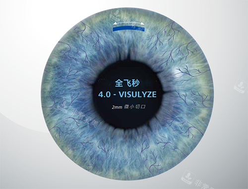 蔡司全飞秒4.0