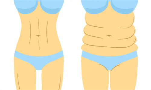 鄭州吸脂塑形醫(yī)院排名:熱門選韓辰華領(lǐng)整形，5G天使光雕吸脂改善比較快!