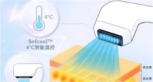 我在韩国做索夫波Sofwave避坑指南：单次价格150万韩元起，对比热玛吉性价比更高，维持18个月