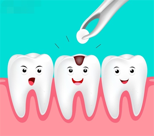 我在韩国治疗虫牙/蛀牙的经历及价格：韩国补牙费用是30万韩币一颗，我补牙4颗价格120万韩币