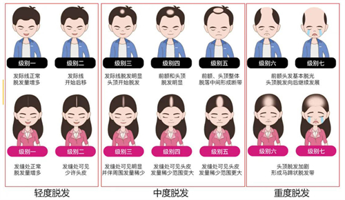 西昌恒美植发医院怎么样？地址在哪里？植发价格多少钱？医院简介地址及价格表一览！