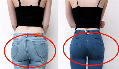 韩国MIND整形外科是相当靠谱的皮肤科！患者真实分享：技术在线服务贴心！