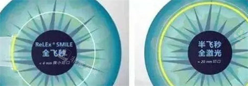 全飞秒和半飞秒