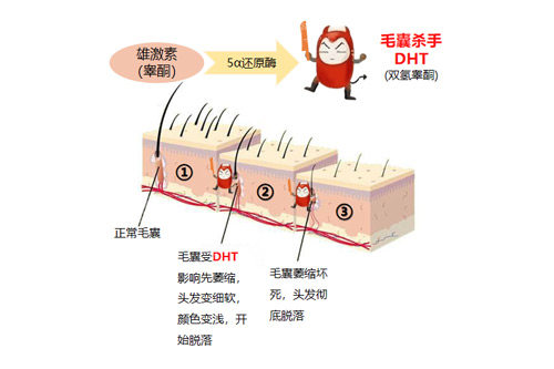毛发缺少原因图