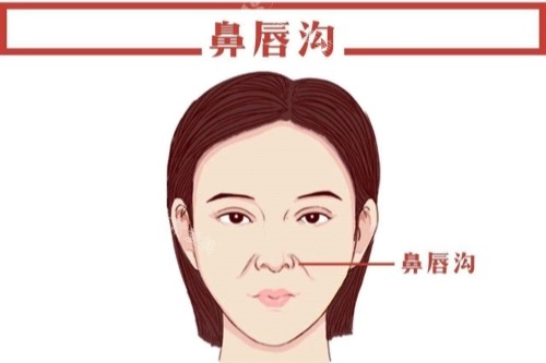 鼻唇沟卡通图 鼻唇沟卡通图