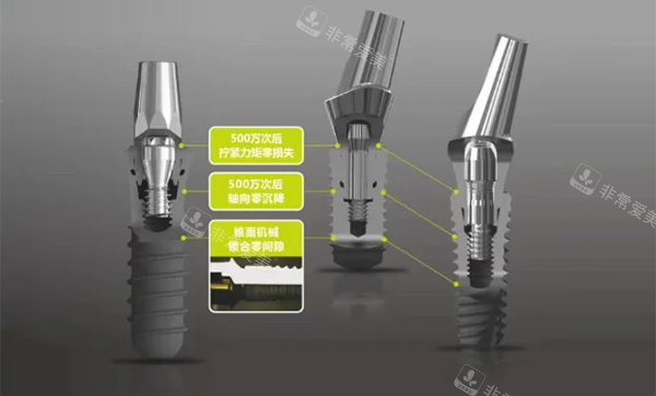百康特种植牙怎么样