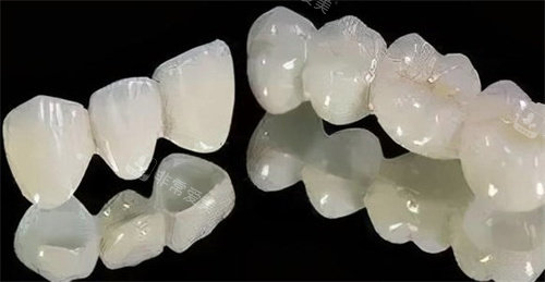 二氧化锆全瓷牙