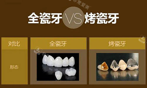 烤瓷牙和全瓷牙对比展示图