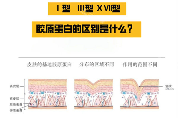 胶原蛋白一型和三型对比区别 胶原蛋白一型和三型对比区别