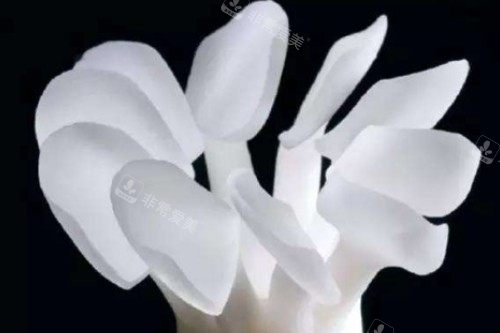 牙齿贴片模型图