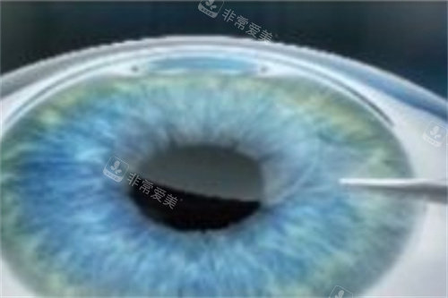 全飞秒分离基质层