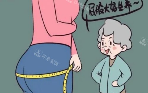 臀部填充后示意图 臀部填充后示意图