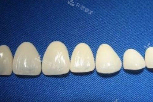 烤瓷牙冠卡通展示图
