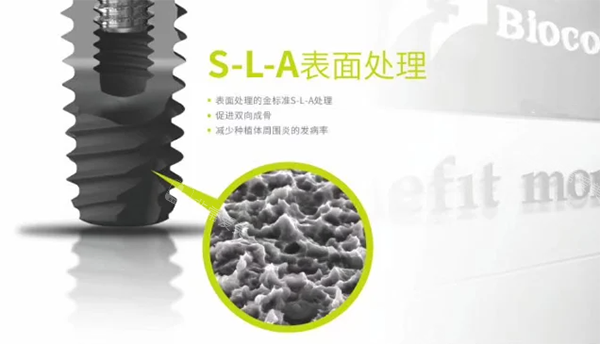 百康特种植牙种植体表面设计