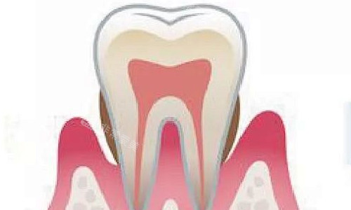 中午牙周炎展示