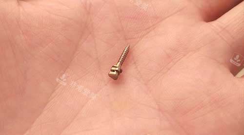 牙齿矫正骨钉种植钉3