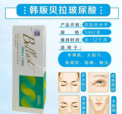 贝拉玻尿酸中分子型号.webp