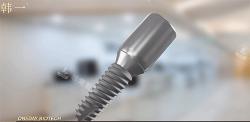 韩一种植牙好不好