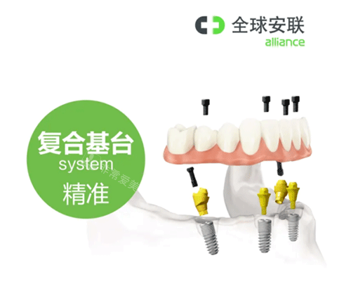 安联种植牙复合基台照片