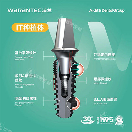 沃兰种植牙IT型号照片