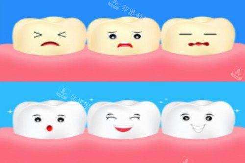 牙齿美白卡通展示