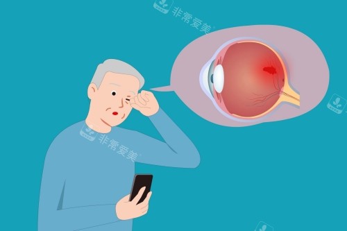 老年人白内障卡通图片展示