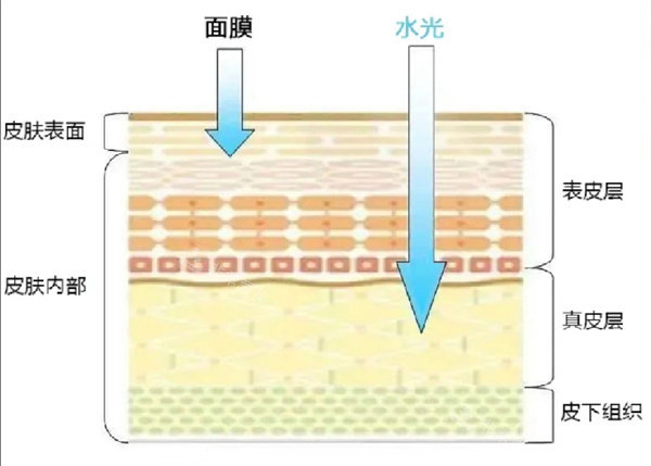 水光针