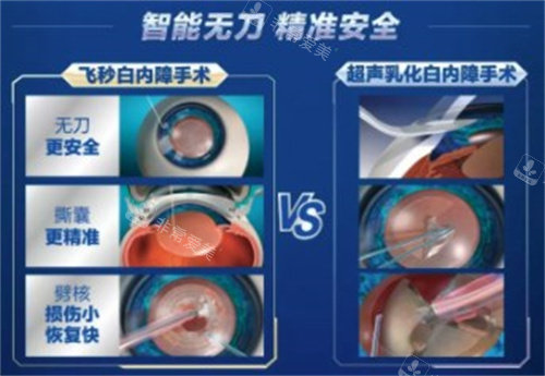爱尔眼科白内障手术