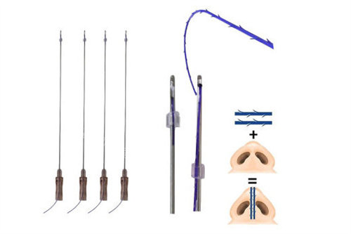 米诺瓦鼻小柱蛋白线