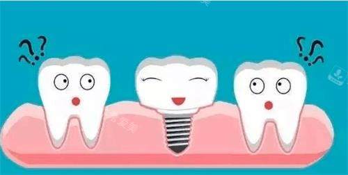 种植牙漫画演示图