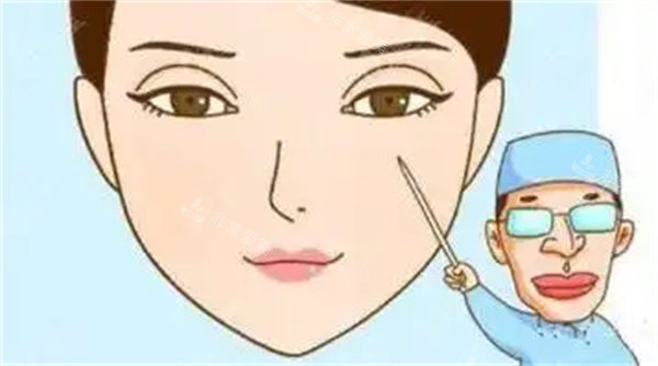 双眼皮疤痕修复手术 双眼皮疤痕修复手术