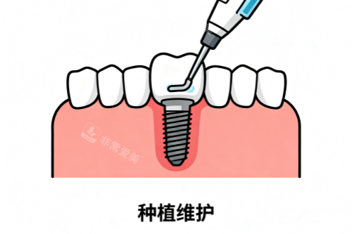 种植牙维护卡通图