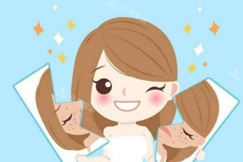 激光祛斑前后对比展示图 激光祛斑前后对比展示图