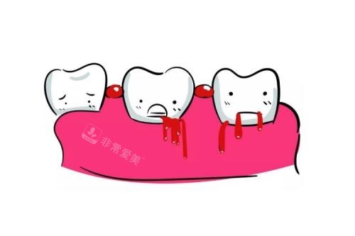 牙齿出血卡通图片展示