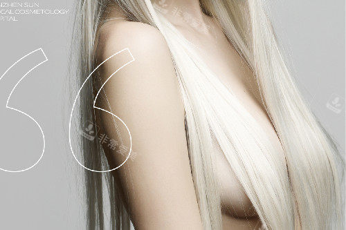 假体隆胸 假体隆胸