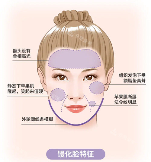 饅化臉怎么辦 饅化臉怎么辦